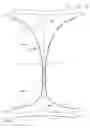 Fig. 03 - System comprising thong-shaped holder and absorbent interlabial article