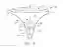 Fig. 07 - System comprising thong-shaped holder and absorbent article