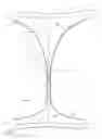 Fig. 03 - System comprising thong-shaped holder and absorbent article