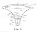 Fig. 07 - System comprising thong-shaped holder and absorbent article