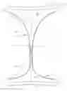 Fig. 01 - System comprising thong-shaped holder and absorbent article
