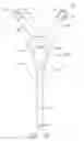Fig. 13 - System comprising thong-shaped holder and extensible absorbent article