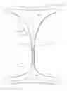 Fig. 01 - System comprising thong-shaped holder and absorbent article with medial hump