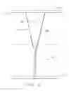 Fig. 04 - Method for holding article in close bodily contact with thong-shaped holder