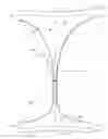 Fig. 01 - System comprising thong-shaped holder and absorbent article
