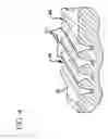Fig. 06 - METHOD AND DEVICE FOR ABRADING SKIN