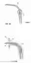 Fig. 17 - Apparatus and method for delivering therapeutic and/or other agents to the inner ear and to other tissues