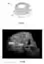 Fig. 23 - Apparatus and method for delivering therapeutic and/or other agents to the inner ear and to other tissues