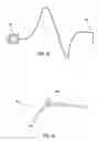 Fig. 24 - Apparatus and method for delivering therapeutic and/or other agents to the inner ear and to other tissues