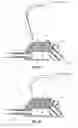 Fig. 23 - Infusion apparatuses and related methods