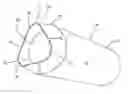 Fig. 01 - Improved Catheters