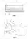 Fig. 02 - Improved Catheters