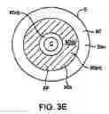 Fig. 08 - Scleral lenses for custom optic evaluation and visual performance improvement