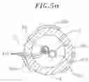 Fig. 08 - Catheter with multiple microfabricated temperature sensors