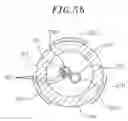 Fig. 09 - Catheter with multiple microfabricated temperature sensors