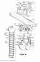 Fig. 02 - Multistage spinal fixation locking mechanism