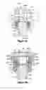 Fig. 05 - Multistage spinal fixation locking mechanism