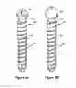 Fig. 08 - Multistage spinal fixation locking mechanism