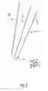 Fig. 03 - System and method for orthopedic implant configuration