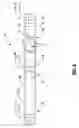 Fig. 03 - Pedicle screw-based dynamic posterior stabilization systems and methods