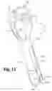 Fig. 07 - Instruments and methods for minimally invasive spinal stabilization
