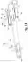 Fig. 09 - Instruments and methods for minimally invasive spinal stabilization