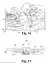 Fig. 22 - Instruments and methods for minimally invasive spinal stabilization