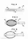 Fig. 04 - Selectively-expandable bone scaffold