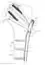 Fig. 01 - Bone fixation system
