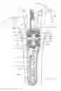 Fig. 03 - Bone fixation system