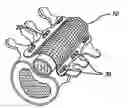 Fig. 01 - Bone anchored surgical mesh