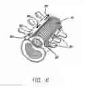 Fig. 05 - Bone anchored surgical mesh