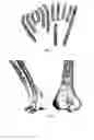 Fig. 04 - Osteosynthesis plate set
