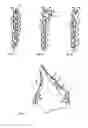 Fig. 06 - Osteosynthesis plate set
