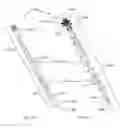 Fig. 07 - Methods of using minimally invasive actuable bone fixation devices
