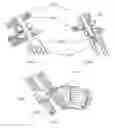 Fig. 08 - Methods of using minimally invasive actuable bone fixation devices