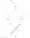 Fig. 13 - Methods of using minimally invasive actuable bone fixation devices