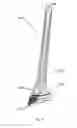 Fig. 15 - Methods of using minimally invasive actuable bone fixation devices