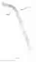 Fig. 16 - Methods of using minimally invasive actuable bone fixation devices
