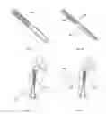 Fig. 22 - Methods of using minimally invasive actuable bone fixation devices