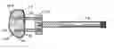 Fig. 01 - Laparoscopic spinal stabilization surgical method