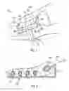 Fig. 02 - Surgical jig