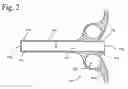 Fig. 03 - Graft syringe assembly
