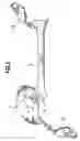 Fig. 03 - Method and device for determination of the mobility of a hip joint prosthesis