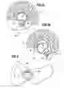 Fig. 04 - Method and device for determination of the mobility of a hip joint prosthesis