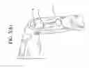 Fig. 10 - Orthopedic implant bender