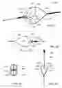 Fig. 04 - Surgical device for retrieval of foreign objects from a body