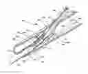 Fig. 01 - Suture loop closure device