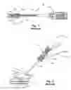 Fig. 02 - Suture loop closure device