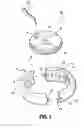 Fig. 02 - Gastric restrictor assembly and method of use